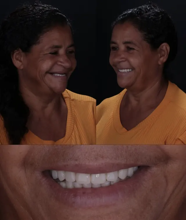 Paciente antes e depois do tratamento