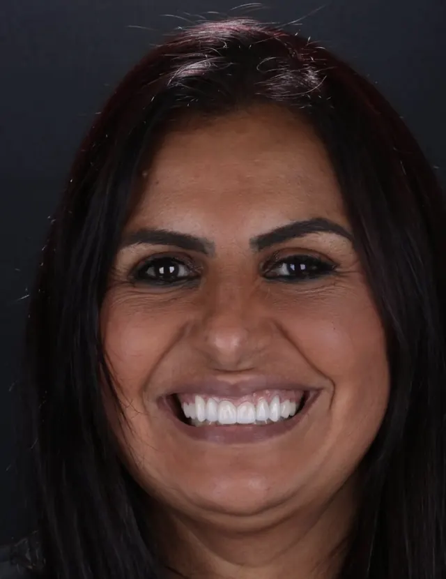 Paciente sorrindo após tratamento estético