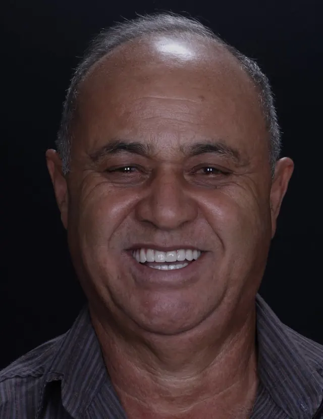 Paciente sorrindo após reabilitação oral