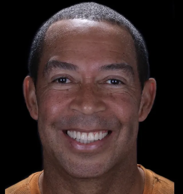 Paciente sorrindo após o tratamento